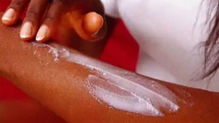 චර්ම රෝග බරපතළ සෞඛ්ය ගැටලුවක් – වෛද්යවරු අනතුරු අඟවයි